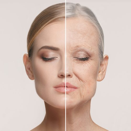 Comparison. Portrait of beautiful woman with problem and clean skin, aging and youth concept, beauty treatment and lifting. Before and after concept. Youth, old age. Process of aging and rejuvenation